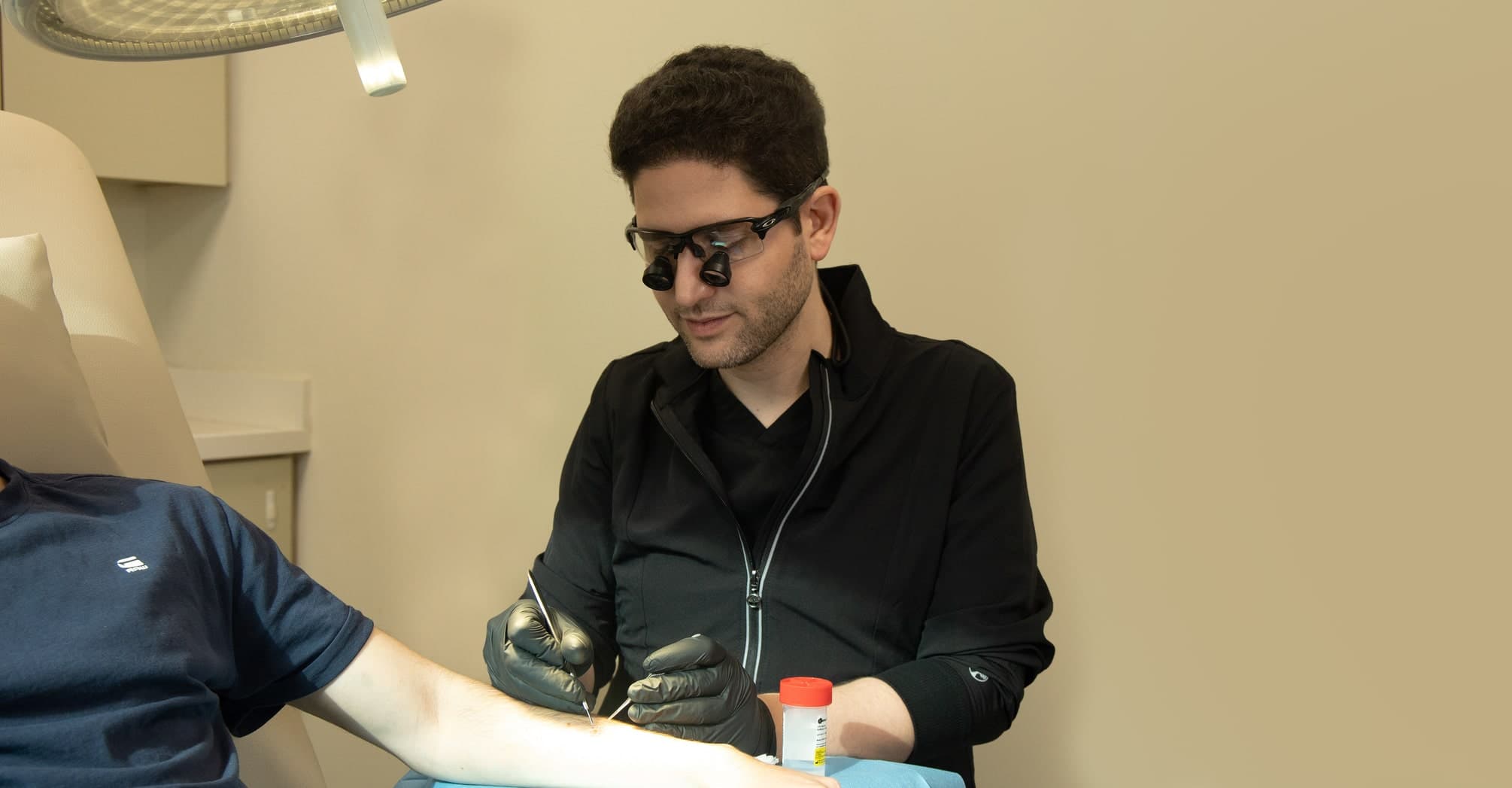 הסרת שומות ונגעי עור